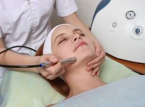 Face laser rejuvenation
