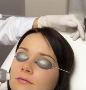 Laser rejuvenation in the field