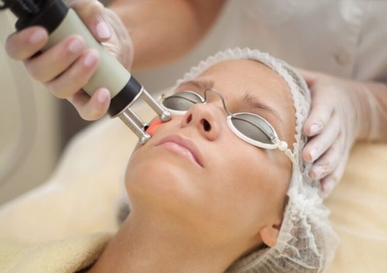 Field laser rejuvenation procedure