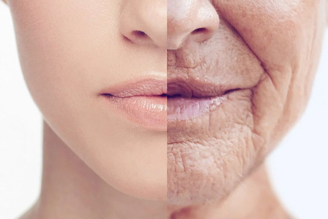Skin deterioration with age
