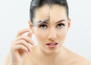 Girl after fractional laser facial rejuvenation
