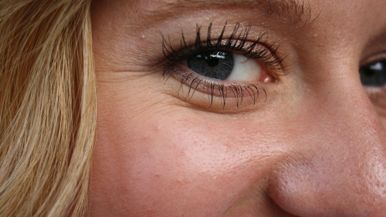 The appearance of wrinkles is a natural process