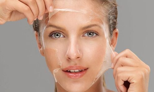Deep peeling improves skin regeneration processes and rejuvenates it